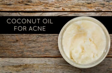 Coconut Oil For Acne and Blemishes